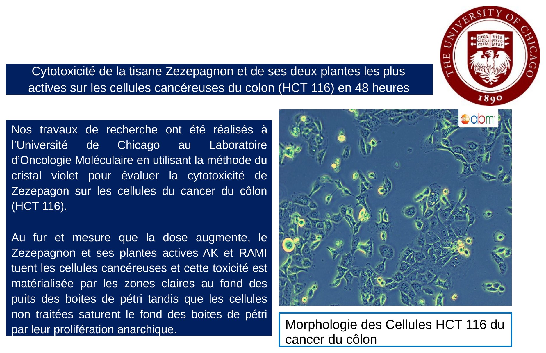 Morphologie des cellules HCT116 — diapositive 3
